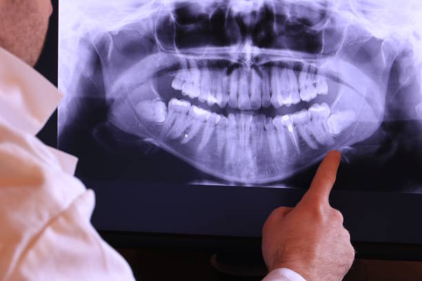 Best Walk-In Emergency Dentist in Many, LA