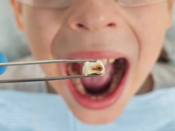 Best Emergency Dental Care for Trauma or Injury in Many, LA